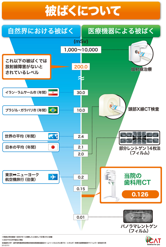 歯科用CT