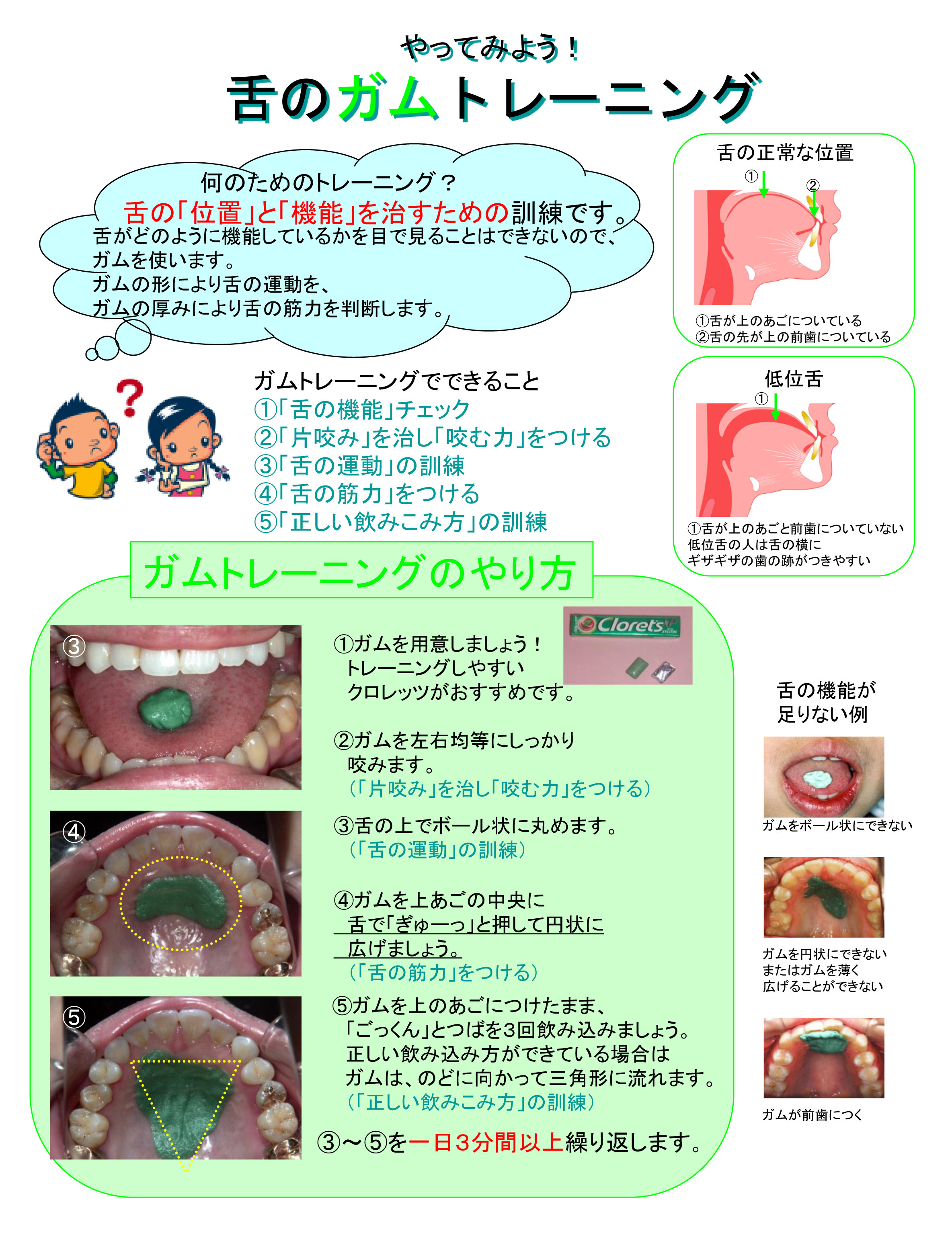 ガムを舌で丸めることできますか できなければ低位舌かも ガムトレーニングで舌を鍛えましょう 調布市の歯科 歯医者ならあきら歯科 柴崎駅改札正面