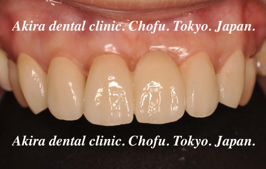 f99401f92c45375effbd608afacb5c